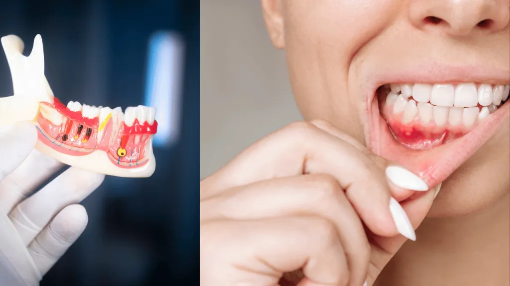 mental health effect on tooth and mouth